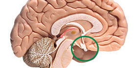 Гипопитуитаризм у детей - симптомы, признаки, диагностика и лечение