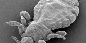 Как избавиться от вшей дома?