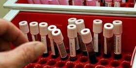 Иммунодиагностика опухолей