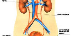 Инфекции мочевой системы