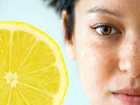 Как избавиться от веснушек быстро Kak-izbavit-sya-ot-vesnushek-bystro