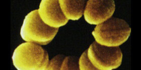 Неонатальные менингиты