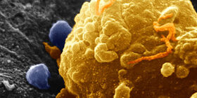 ОТВЕТ ОРГАНИЗМА НА ОПУХОЛЬ