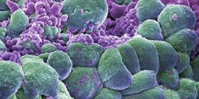 Развитие раковых опухолей