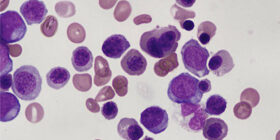 Цитопении фото