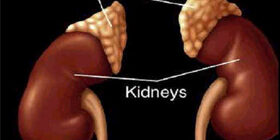 Врожденная гиперплазия надпочечников