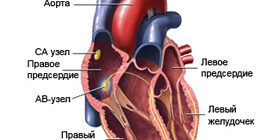 Врожденные пороки развития сердца и кровеносных сосудов