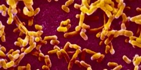 Бубонная чума