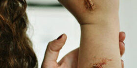 Как нарисовать шрам на Хэллоуин на руке и лице