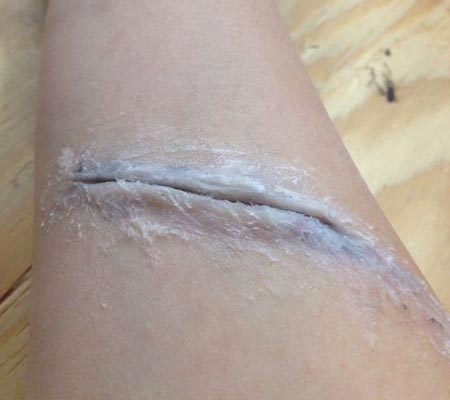 Как сделать шрам из грима в домашних условиях на Хэллоуин