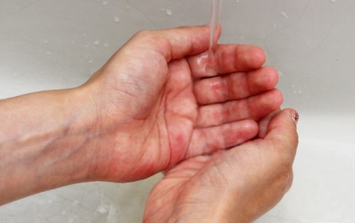 Как вылечить трещины на руках — хорошие советы