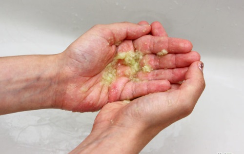 Как вылечить трещины на руках — хорошие советы