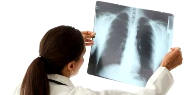 Врач диагностирует пневмонию фото