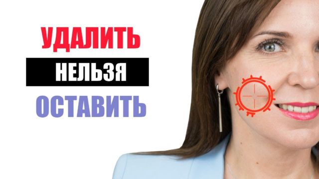 udalenie-komochkov-bisha-foto-3