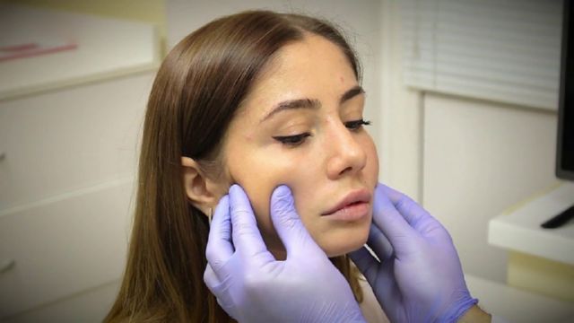 udalenie-komochkov-bisha-foto-6